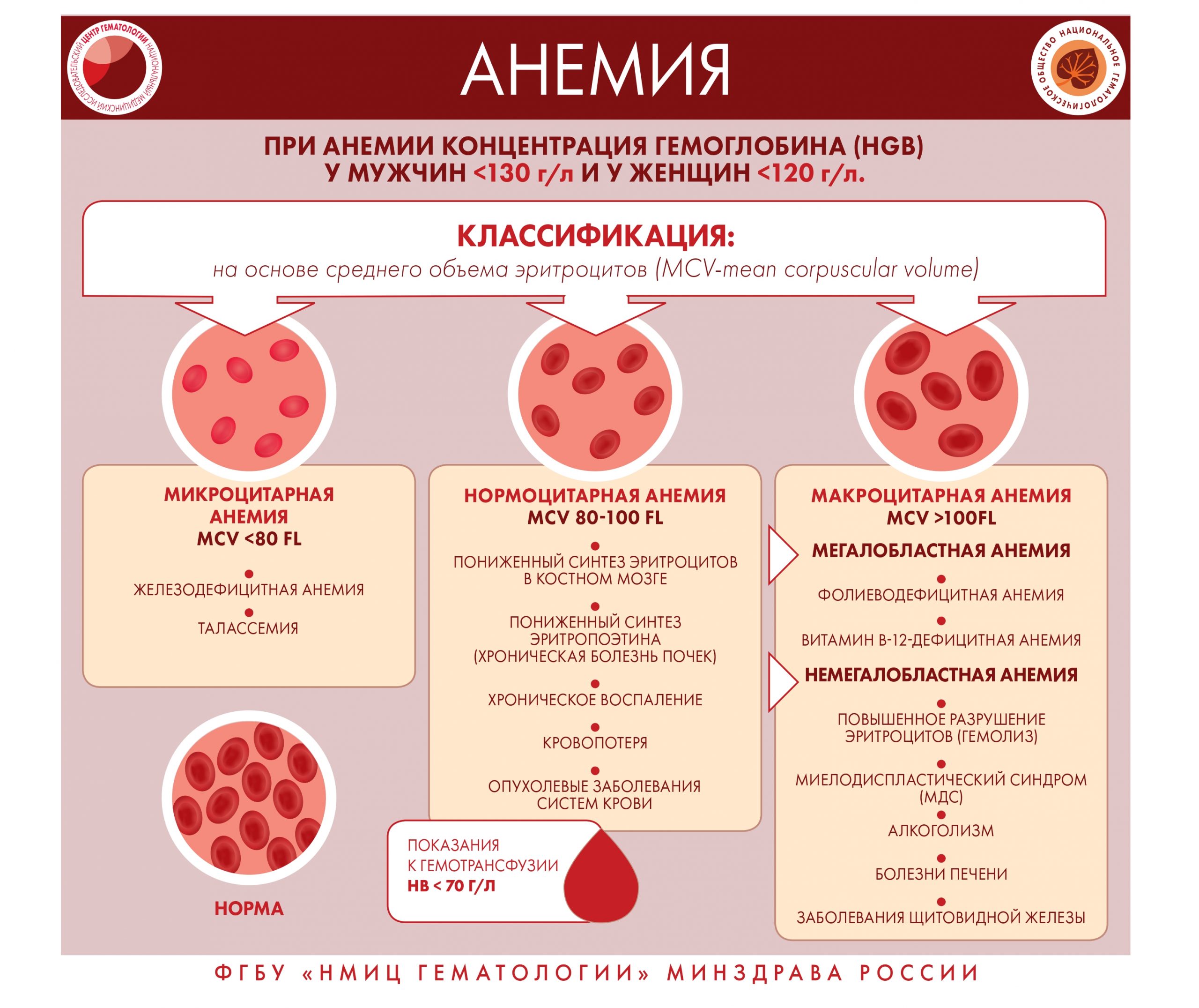 Специалистами ФГБУ «НМИЦ гематологии» Минздрава России разработана серия  инфографики, где в простой и доступной форме представлена информация о  заболеваниях системы крови | Министерство здравоохранения Республики  Мордовия